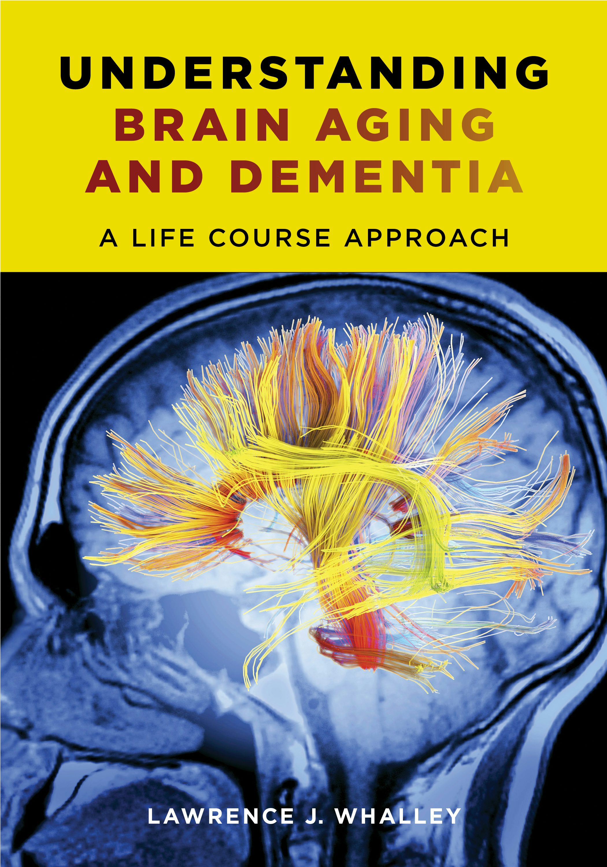 Book cover image for Understanding Brain Aging and Dementia ISBN: 9780231163835